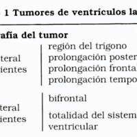 Tumores de los Ventrículos Laterales en la Infancia