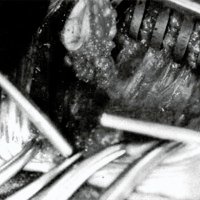 Fig. 3. Caso 4: Resección quirúrgica del tracto.
