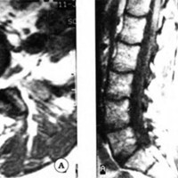 Fig. 2. Caso 2