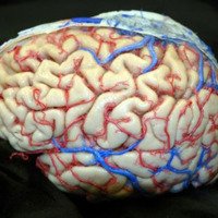 Figura 18: Relaciones arteriales del hemisferio cerebral izquierdo evidenciando los ramos corticales de la arteria cerebral media (M4).