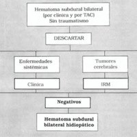 Hematoma Subdural Bilateral Idiopático