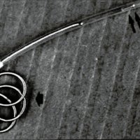 Fig. 2: espiral de platino (flecha simple) en el momento de su salida del microcatéter mientras es avanzada por empuje de un mandril de nylon, flexible (flecha doble),