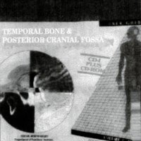 Temporal Bone &amp; Posterior Cranial Fossa.