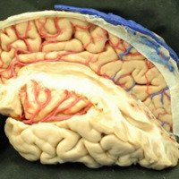 Figura 25: Relación de los segmentos M2 da arteria cerebral media con los giros insulares.