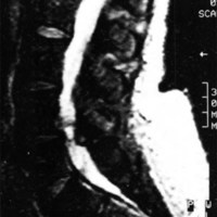 Fig 3. Caso 3