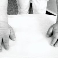 Fig. 2. Trastornos del desarrollo óseos característicos: ambas manos de la paciente en estudio, vista dorsal.