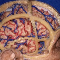 Figura 19: Relación de los ramos corticales de la arteria cerebral media con las principales suturas del cráneo, a partir de estas medidas se calcula las relaciones entre las suturas y los surcos y giros.