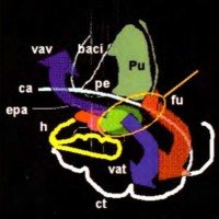 Fig. 16. Resumen esquemático de nuestra concepción del tallo temporal en su porción anterior, representada en un corte coronal del hemisferio izquierdo. 