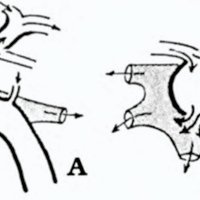 Fig. 4. Esquema circulatorio de una FCC en vista lateral izquierda segúnHamby. 
