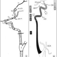 Fig. 5. A. Segmentos de la carótida según la estructura de su pared, tomado de Platzer. B. Segmentos de la carótida según su origen embriológico tomado de Gailloud et al, basado en Lasjaunias