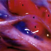 Fig. 4. Vista superolateral (magnificada) del seno cavernoso derecho. 