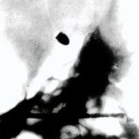 Fig. 4. Radiografia de una bala en la base de cráneo obtenida por Schuster en abril de 1896