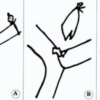 Fig. 2. A. y B. Resumen gráfico de los pasos de la técnica de producción de los aneurismas. Obsérvese el corte oblicuo de la vena y la incisión lateral en la misma. C. Técnica de introducción del catéter: 1: ligadura distal; 2: doble lazada proximal; 3: arteriotomía; 4: una vez introducido el catéter se ajusta la doble lazada con un clip contra la arteria, como indica la dirección de la cabeza de flecha.