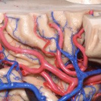 Figura 23: Visión lateral de la ínsula derecha evidenciando el trayecto de los ramos M2 de la arteria cerebral media al largo de los surcos insulares.