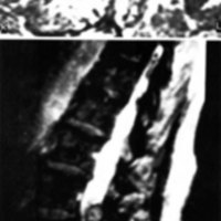 Fig. 4. Caso 4