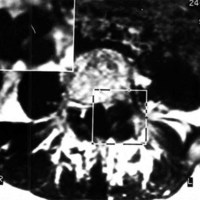 Fig. 5. Caso 5.