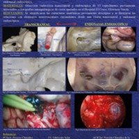 Poster-Anatomia-del-Proceso-Clinoideo-Anterior.jpg