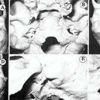 Fig. 1. Relaciones óseas. (A D): vista desde abajo: (E): vista desde lateral: (F): vista desde arriba.
