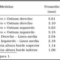 Tabla1. Medidas de los ostia esfenoidales 