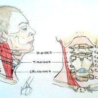 Figura 2: Marcación según nivel. Se observa a nivel del hueso hioides la correspondencia con niveles cervicales altos, tiroides con niveles medios, cricoides con niveles bajos (Ilustración).