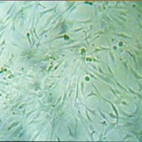 Fig. 3. Células en cultivo observadas con microscopio invertido de contraste de fase. Al día 5 las células ocupan toda la placa y no se observa más desarrollo celular