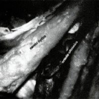 Fig. 6. Vista superior del nacimiento de la arteria oftámica (flechas), su relación con el nervio óptico.