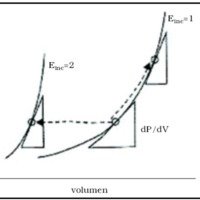 Fig. 3. Curva presión-volumen de una arteria.