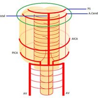 Figura 1A: Esquema 3D sistema vertebrobasilar – www.neuroangio.org
