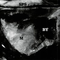 Fig. 4. Preparado anatómico que ilustra el seno sigmoideo (SS), el seno petroso superior (SPS), y al fresar la mastoides (M), el bulbo de la yugular (BY).