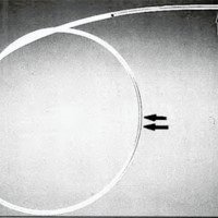 Fig. 1B. Microcatéter 3.0F/ 2.2F de material hidrofilico ultraflexible (flecha) y extremo de nylon premoldeable (flecha doble).