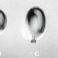 Fig. 3. Modelos de microbalones oclusivos. A. Desinflado antes de montar en catéter. B,C y D. Inflados y desprendidos